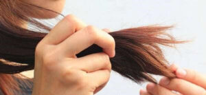 وصفات طبيعية فعالة لعلاج تقصف الشعر 1